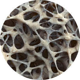 Osteoporwsi Image Here